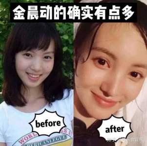 ​阚清子整容，阚清子多高(阚清子真实身高)