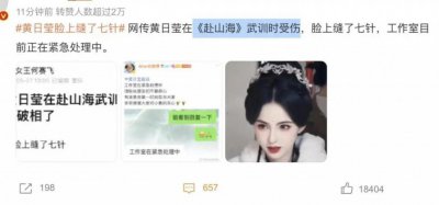 ​长得太像李若彤了！30岁女演员武训时受伤，脸上被缝了7针